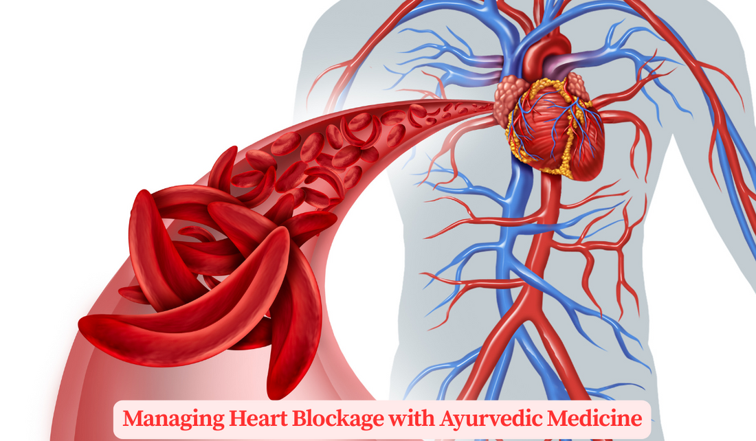 Managing Heart Blockage with Ayurvedic Medicine: Insights, Treatments, and Success Stories